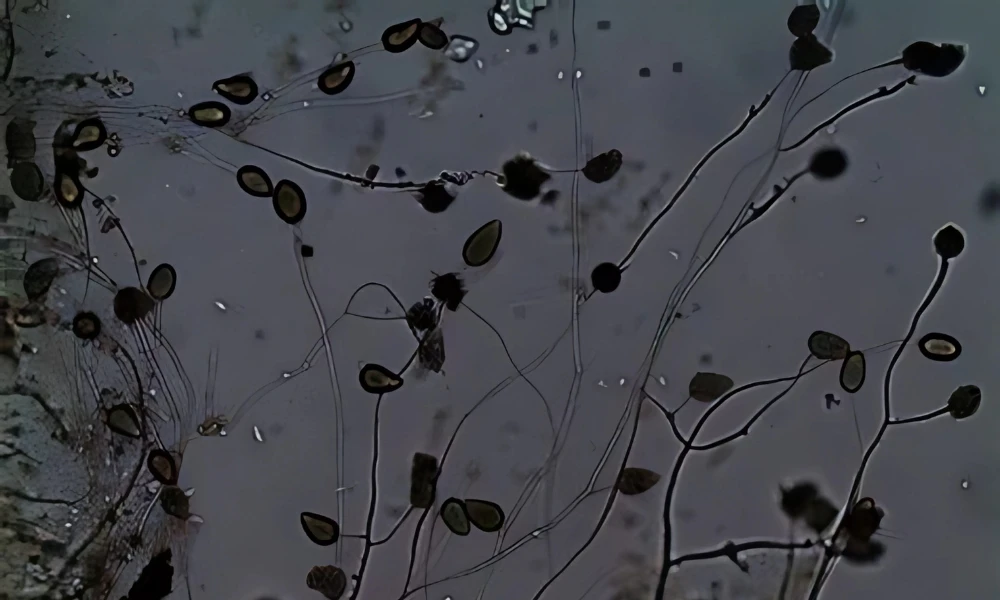 BỆNH CHẾT NHANH TRÊN CÂY HỒ TIÊU: NGUYÊN NHÂN VÀ CÁCH XỬ LÝ HIỆU QUẢ NHẤT